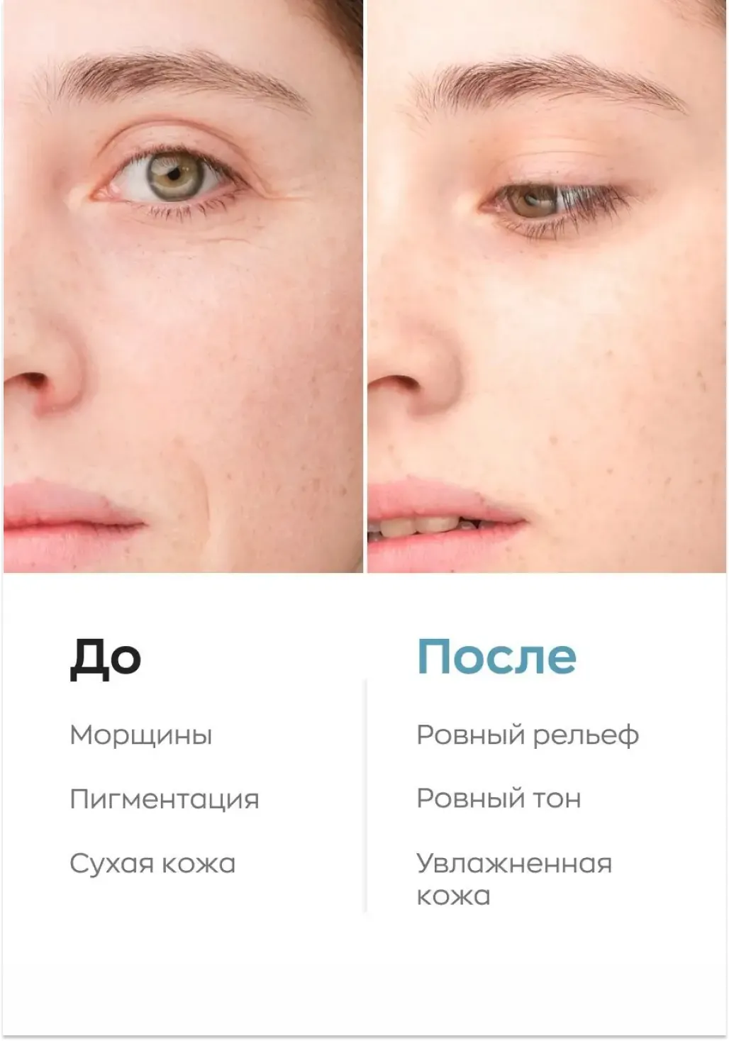 productImg