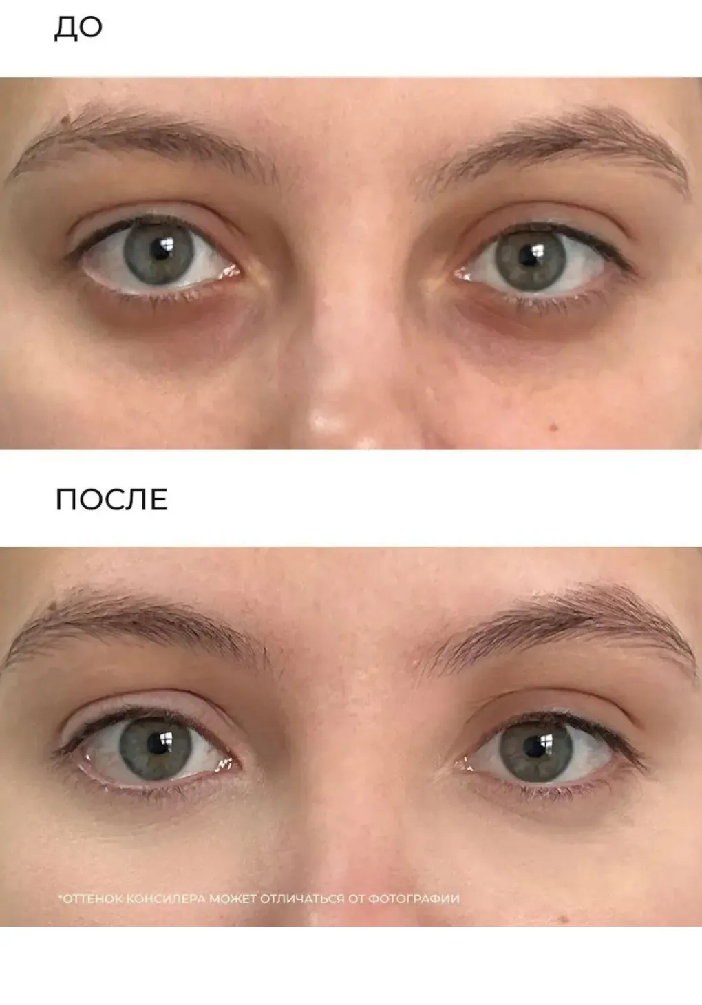 productImg